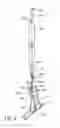 Fig. 04 - Deployment instrument for closure device for percutaneously sealing punctures
