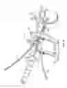 Fig. 09 - Surgical access system and related methods
