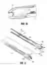 Fig. 07 - Surgical clip applier