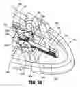 Fig. 35 - Surgical clip applier