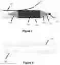 Fig. 02 - Embolic containment