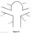 Fig. 06 - Embolic containment