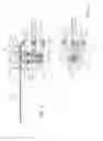 Fig. 04 - Surgical reciprocating blade assembly including a static guide bar, teeth that project from a side of the guide bar and a drive rod that reciprocates the teeth