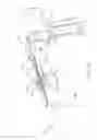 Fig. 09 - Surgical reciprocating blade assembly including a static guide bar, teeth that project from a side of the guide bar and a drive rod that reciprocates the teeth