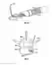 Fig. 05 - Devices and methods for the preparation of intervertebral discs