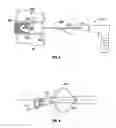 Fig. 07 - Devices and methods for the preparation of intervertebral discs