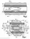 Fig. 04 - More Efficiently and Effectively Removing Stenotic And Restenotic Plaque From Arteries