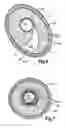 Fig. 06 - More Efficiently and Effectively Removing Stenotic And Restenotic Plaque From Arteries