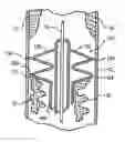 Fig. 01 - Adjustable ring stripper for more efficiently and effectively removing plaque from arteries