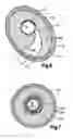 Fig. 06 - Adjustable ring stripper for more efficiently and effectively removing plaque from arteries