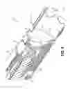 Fig. 03 - Tissue-removing catheter with rotatable cutter