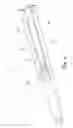 Fig. 03 - Magnetic Resonance Compatible RF Transseptal System