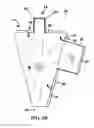 Fig. 07 - Sealed distal end prosthesis insertion bag