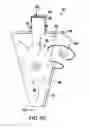 Fig. 09 - Sealed distal end prosthesis insertion bag