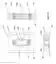 Fig. 02 - Flexible plate fixation of bone fractures