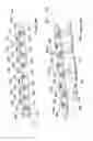 Fig. 09 - Flexible plate fixation of bone fractures