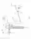 Fig. 08 - Remotely-activated vertebroplasty injection device