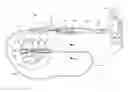 Fig. 01 - Shape changing ablation balloon