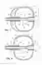 Fig. 06 - Shape changing ablation balloon
