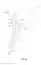 Fig. 18 - Catheter with jet impingement cooled thermoelectric module