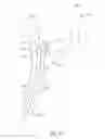 Fig. 32 - Catheter with jet impingement cooled thermoelectric module