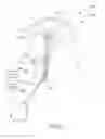 Fig. 33 - Catheter with jet impingement cooled thermoelectric module