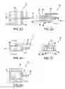 Fig. 08 - INSTRUMENTS AND METHODS FOR THERMAL TISSUE TREATMENT
