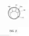 Fig. 04 - Tissue extraction devices and methods
