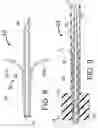 Fig. 09 - Methods of ablating tissue using a catheter injection system