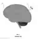 Fig. 02 - Trackable apparatuses and methods
