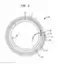Fig. 03 - Package assembly for sterile and convenient insertion of dilator into sheath