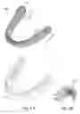 Fig. 02 - Dental positioning appliance having mesh portion