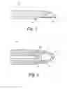 Fig. 02 - Tip for an intraoral scanner