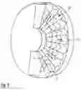 Fig. 04 - Dental prosthesis