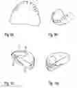 Fig. 07 - Dental prosthesis