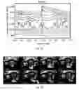 Fig. 07 - System, device and method for observing piglet birth