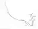 Fig. 01 - METHOD OF TREATING URINARY INCONTINENCE BY IMPLANTING A TRANSVAGINAL MID-URETHRAL SLING INTO A PERSON