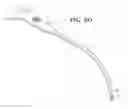 Fig. 08 - METHOD OF TREATING URINARY INCONTINENCE BY IMPLANTING A TRANSVAGINAL MID-URETHRAL SLING INTO A PERSON