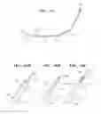 Fig. 43 - METHOD OF TREATING URINARY INCONTINENCE BY IMPLANTING A TRANSVAGINAL MID-URETHRAL SLING INTO A PERSON