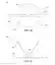 Fig. 03 - Removable deployment device, system, and method for implantable prostheses
