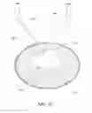 Fig. 08 - Removable deployment device, system, and method for implantable prostheses