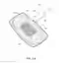 Fig. 28 - Removable deployment device, system, and method for implantable prostheses