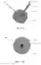 Fig. 35 - Removable deployment device, system, and method for implantable prostheses