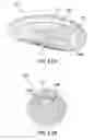 Fig. 44 - Removable deployment device, system, and method for implantable prostheses