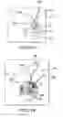 Fig. 48 - Removable deployment device, system, and method for implantable prostheses