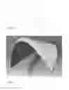 Fig. 08 - CELL SCAFFOLD CONSTRUCTS