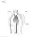 Fig. 02 - Expansible cardiovascular graft system