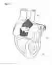 Fig. 08 - Expansible cardiovascular graft system
