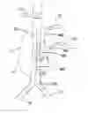 Fig. 01 - Aneurysm Treatment Method