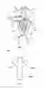 Fig. 08 - Aneurysm Treatment Method